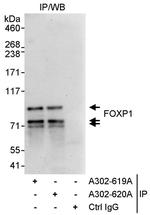 FOXP1 Antibody in Immunoprecipitation (IP)