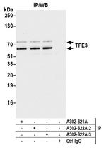 TFE3 Antibody in Immunoprecipitation (IP)