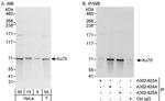 Ku70 Antibody in Western Blot (WB)