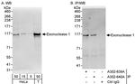 Exonuclease 1 Antibody in Western Blot (WB)