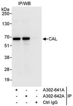 CAL Antibody in Immunoprecipitation (IP)