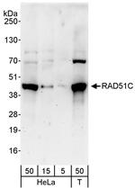 RAD51C Antibody in Western Blot (WB)