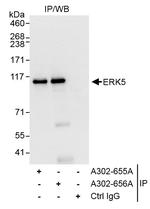 ERK5 Antibody in Immunoprecipitation (IP)