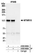 MTMR15 Antibody in Immunoprecipitation (IP)