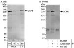 GCP6 Antibody in Western Blot (WB)