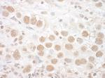 CTNNBL1 Antibody in Immunohistochemistry (Paraffin) (IHC (P))