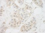 UCKL1 Antibody in Immunohistochemistry (Paraffin) (IHC (P))