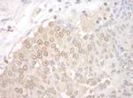 UCKL1 Antibody in Immunohistochemistry (Paraffin) (IHC (P))