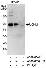 UCKL1 Antibody in Immunoprecipitation (IP)