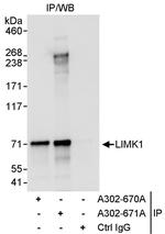 LIMK1 Antibody in Immunoprecipitation (IP)