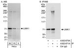 LIMK1 Antibody in Western Blot (WB)