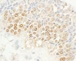 NEK4 Antibody in Immunohistochemistry (Paraffin) (IHC (P))