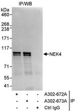 NEK4 Antibody in Immunoprecipitation (IP)