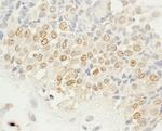 NEK4 Antibody in Immunohistochemistry (Paraffin) (IHC (P))