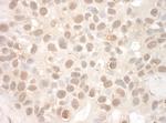 EYA2 Antibody in Immunohistochemistry (Paraffin) (IHC (P))