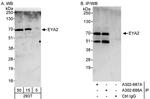 EYA2 Antibody in Western Blot (WB)