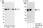 EYA3 Antibody in Western Blot (WB)