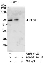 KLC1 Antibody in Immunoprecipitation (IP)