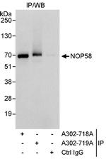 NOP58 Antibody in Immunoprecipitation (IP)