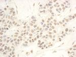 NOP56 Antibody in Immunohistochemistry (Paraffin) (IHC (P))