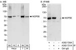 NOP56 Antibody in Western Blot (WB)