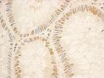 NOP56 Antibody in Immunohistochemistry (Paraffin) (IHC (P))