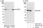 NOP56 Antibody in Western Blot (WB)