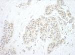 Pygo2 Antibody in Immunohistochemistry (Paraffin) (IHC (P))