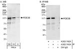 PDE3B Antibody in Western Blot (WB)