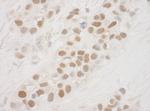 MSK1 Antibody in Immunohistochemistry (Paraffin) (IHC (P))