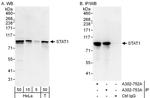 STAT1 Antibody in Western Blot (WB)