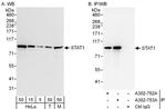 STAT1 Antibody in Western Blot (WB)