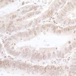 NFAT3 Antibody in Immunohistochemistry (Paraffin) (IHC (P))