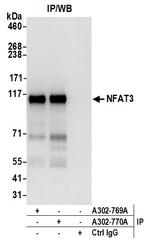 NFAT3 Antibody in Immunoprecipitation (IP)