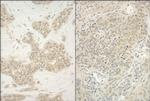 YY1 Antibody in Immunohistochemistry (Paraffin) (IHC (P))