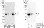 AIF Antibody in Western Blot (WB)