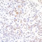 API5 Antibody in Immunohistochemistry (Paraffin) (IHC (P))