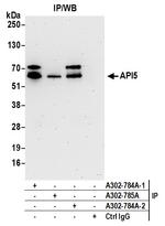 API5 Antibody in Immunoprecipitation (IP)