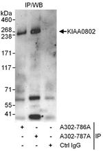 KIAA0802 Antibody in Immunoprecipitation (IP)