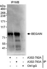 BEGAIN Antibody in Immunoprecipitation (IP)