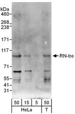 RN-tre Antibody in Western Blot (WB)