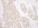 BAG3 Antibody in Immunohistochemistry (Paraffin) (IHC (P))