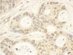 CIAPIN1 Antibody in Immunohistochemistry (Paraffin) (IHC (P))