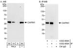 CIAPIN1 Antibody in Western Blot (WB)