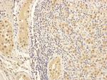 MAP1S Antibody in Immunohistochemistry (Paraffin) (IHC (P))