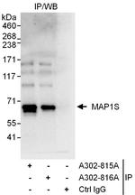 MAP1S Antibody in Immunoprecipitation (IP)