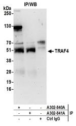 TRAF4 Antibody in Immunoprecipitation (IP)