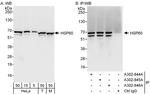 HSP60 Antibody in Western Blot (WB)