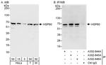 HSP60 Antibody in Western Blot (WB)