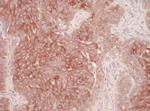 Derlin-1 Antibody in Immunohistochemistry (Paraffin) (IHC (P))